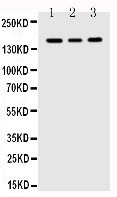 Anti-FLT1 antibody, PA1399, Western blotting
Lane 1: MCF-7 Cell Lysate
Lane 2: SGC Cell Lysate
Lane 3: MM231 Cell Lysate