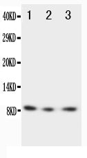 Anti-CX3CL1 antibody, PA1400, Western blotting
Lane 1: Recombinant Human Fractalkine Protein 10ng
Lane 2: Recombinant Human Fractalkine Protein 5ng
Lane 3: Recombinant Human Fractalkine Protein 2.5ng