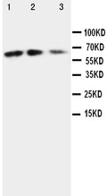 Anti-CX3CL1 antibody, PA1401, Western blotting
Lane 1: Recombinant Mouse Fractalkin Protein 10ng
Lane 2: Recombinant Mouse Fractalkin Protein 5ng
Lane 3: Recombinant Mouse Fractalkin Protein 2.5ng