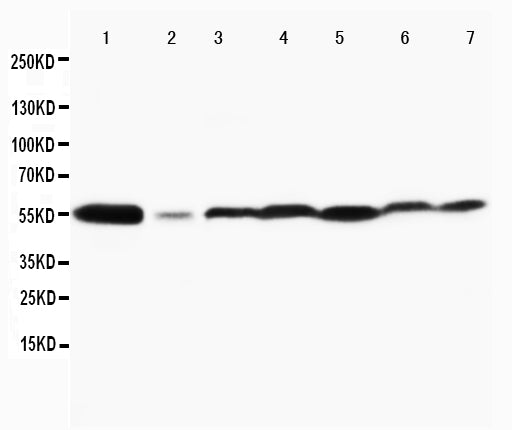 Anti-MAPK8/9 antibody, PA1407, Western blotting
Lane 1: Rat Brain Tissue Lysate
Lane 2: Rat Thymus Tissue Lysate
Lane 3: MCF-7 Cell Lysate
Lane 4: HELA Cell Lysate
Lane 5: JURKAT Cell Lysate
Lane 6: MM231 Cell Lysate
Lane 7: CEM Cell Lysate