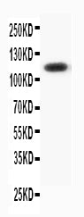Anti-Progesterone Receptor antibody, PA1413, Western blotting
WB: HELA Cell Lysate