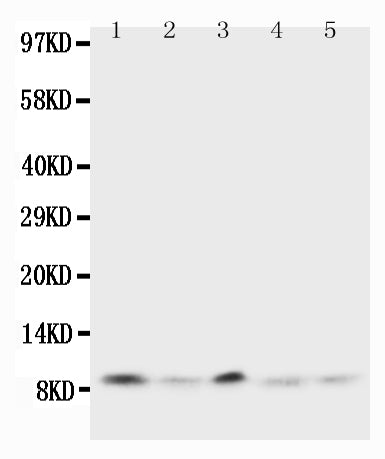 Anti-Ubiquitin antibody, PA1420, Western blotting
Lane 1: Rat Thymus Tissue Lysate
Lane 2: Human MCF-7 Cell Lysate
Lane 3: MM231 Cell Lysate
Lane 4: HELA Cell Lysate
Lane 5: SMMC Cell Lysate