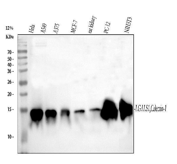 Anti-Galectin 1/LGALS1 Antibody Picoband®