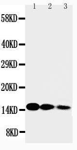 Anti-IL-3 antibody, PA1423, Western blotting
Lane 1: Recombinant Human IL-3 Protein 10ng
Lane 2: Recombinant Human IL-3 Protein 5ng
Lane 3: Recombinant Human IL-3 Protein 2.5ng