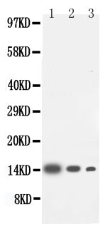 Anti-IL-4 antibody, PA1424, Western blotting
Lane 1: Recombinant Human IL-4 Protein 10ng
Lane 2: Recombinant Human IL-4 Protein 5ng
Lane 3: Recombinant Human IL-4 Protein 2.5ng