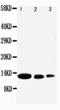 Anti-CXCL9 antibody, PA1429, Western blotting
Lane 1: Recombinant Human CXCL9 Protein 10ng
Lane 2: Recombinant Human CXCL9 Protein 5ng
Lane 3: Recombinant Human CXCL9 Protein 2.5ng