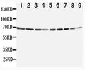Anti-Annexin VI antibody, PA1436, Western blotting
Lane 1: Rat Ovary Tissue Lysate
Lane 2: Rat Liver Tissue Lysate
Lane 3: Rat Intestinum Tenue Tissue Lysate
Lane 4: Rat Brain Tissue Lysate
Lane 5: A549 Cell Lysate
Lane 6: JURKAT Cell Lysate

Lane 7: RAJI Cell Lysate

Lane 8: CEM Cell Lysate

Lane 9: SMMC Cell Lysate