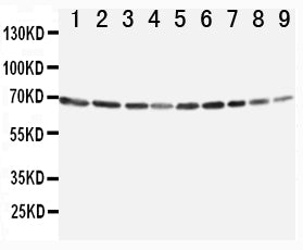 Anti-Annexin VI antibody, PA1436, Western blotting
Lane 1: Rat Ovary Tissue Lysate
Lane 2: Rat Liver Tissue Lysate
Lane 3: Rat Intestinum Tenue Tissue Lysate
Lane 4: Rat Brain Tissue Lysate
Lane 5: A549 Cell Lysate
Lane 6: JURKAT Cell Lysate

Lane 7: RAJI Cell Lysate

Lane 8: CEM Cell Lysate

Lane 9: SMMC Cell Lysate