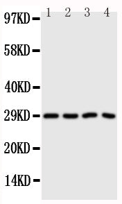 Anti-CA3 antibody, PA1439, Western blotting
Lane 1: SMMC Cell Lysate
Lane 2: HELA Cell Lysate
Lane 3: SW620 Cell Lysate
Lane 4: SCG Cell Lysate