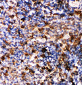 Anti-Caspase-6(P18) antibody, PA1441-1, IHC(P)
IHC(P): Rat Spleen Tissue