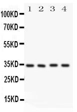 Anti-Caspase-7(P11) antibody, PA1442, Western blotting
All lanes: Anti CASP7(p11) (PA1442) at 0.5ug/ml
Lane 1: HELA Whole Cell Lysate at 40ug
Lane 2: MCF-7 Whole Cell Lysate at 40ug
Lane 3: Rat Liver Tissue Lysate at 50ug
Lane 4: Rat Kidney Tissue Lysate at 50ug
Predicted bind size: 34KD
Observed bind size: 34KD