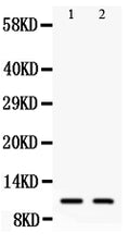 Anti-Eotaxin3 antibody, PA1451, Western blotting
All lanes: Anti Eotaxin3 (PA1451) at 0.5ug/ml
Lane 1: COLO320 Whole Cell Lysate at 40ug
Lane 2: A549 Whole Cell Lysate at 40ug
Predicted bind size: 11KD
Observed bind size: 11KD
