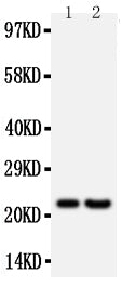 Anti-FGF9 antibody, PA1453, Western blotting
All lanes: Anti FGF9 (PA1453) at 0.5ug/ml
Lane 1: Rat Brain Tissue Lysate at 50ug
Lane 2: HELA Whole Cell Lysate at 40ug
Predicted bind size: 23KD
Observed bind size: 23KD