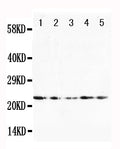Anti-FGF10 antibody, PA1454, Western blotting
Lane 1: U87 Cell Lysate
Lane 2: HELA Cell Lysate
Lane 3: A519 Cell Lysate
Lane 4: 293T Cell Lysate
Lane 5: HELA Cell Lysate