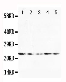 Anti-FGF10 antibody, PA1454, Western blotting
Lane 1: U87 Cell Lysate
Lane 2: HELA Cell Lysate
Lane 3: A519 Cell Lysate
Lane 4: 293T Cell Lysate
Lane 5: HELA Cell Lysate