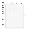 Anti-Fibroblast growth factor 22 FGF22 Antibody Picoband®