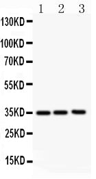Anti-GM-CSF antibody, PA1456, Western blotting
All lanes: Anti GM-CSF (PA1456) at 0.5ug/ml
Lane 1: JURKAT Whole Cell Lysate at 40ug
Lane 2: HELA Whole Cell Lysate at 40ug
Lane 3: HT1080Whole Cell Lysate at 40ug
Predicted bind size: 16KD
Observed bind size: 35KD