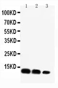Anti-CXCL16 antibody, PA1460, Western blotting
Lane 1: Recombinant Mouse CXCL16 Protein 10ng
Lane 2: Recombinant Mouse CXCL16 Protein 5ng
Lane 3: Recombinant Mouse CXCL16 Protein 2.5ng