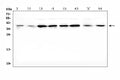 Anti-Dickkopf-related protein 1 DKK1 Antibody Picoband®