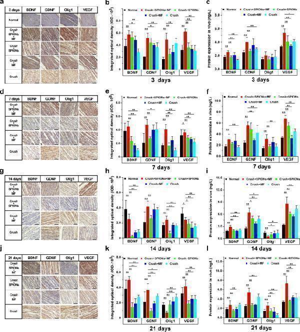 Anti-GDNF Antibody Picoband®