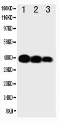 Anti-IL-12(p40) antibody, PA1468, Western blotting
Lane 1: Recombinant Human IL-12 Protein 10ng
Lane 2: Recombinant Human IL-12 Protein 5ng
Lane 3: Recombinant Human IL-12 Protein 2.5ng