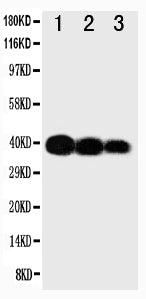 Anti-IL-12(p40) antibody, PA1468, Western blotting
Lane 1: Recombinant Human IL-12 Protein 10ng
Lane 2: Recombinant Human IL-12 Protein 5ng
Lane 3: Recombinant Human IL-12 Protein 2.5ng