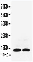 Anti-IL-13 antibody, PA1469, Western blotting
All lanes: Anti IL-13 (PA1469) at 0.5ug/ml
Lane 1: Recombinant Rat IL-13 Protein 5ng
Lane 2: Recombinant Rat IL-13 Protein 2.5ng
Predicted bind size: 13KD
Observed bind size: 13KD