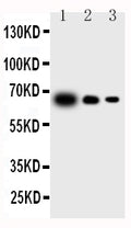 All lanes: Anti-IL23 P19 antibody, PA1470
 Lane 1: Recombinant Mouse IL-23 Protein 10ng
 
Lane 2: Recombinant Mouse IL-23 Protein 5ng
 
Lane 3: Recombinant Mouse IL-23 Protein 2.5ng