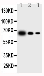 All lanes: Anti-IL23 P19 antibody, PA1470
 Lane 1: Recombinant Mouse IL-23 Protein 10ng
 
Lane 2: Recombinant Mouse IL-23 Protein 5ng
 
Lane 3: Recombinant Mouse IL-23 Protein 2.5ng