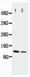 Anti-Resistin antibody, PA1473, Western blotting
Lane 1: Recombinant Mouse Resistin Protein 10ng
Lane 2: Recombinant Mouse Resistin Protein 5ng