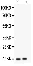 Anti-Fatty Acid Binding Protein 5  antibody, PA1475, Western blotting
All lanes: Anti Fatty Acid Binding Protein 5 (PA1475) at 0.5ug/ml
Lane 1: HELA Whole Cell Lysate at 40ug
Lane 2: HEPG2 Whole Cell Lysate at 40ug
Predicted bind size: 15KD
Observed bind size: 15KD
