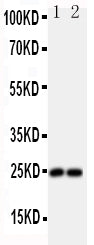 Anti-FGF19 antibody, PA1476, Western blotting
All lanes: Anti FGF19 (PA1476) at 0.5ug/ml
Lane 1: U87 Whole Cell Lysate at 40ug
Lane 2: SMMC Whole Cell Lysate at 40ug
Predicted bind size: 24KD
Observed bind size: 24KD