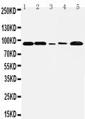 Anti-FGFR1 antibody, PA1477, Western blotting
Lane 1: Rat Liver Tissue Lysate
Lane 2: Rat Brain Tissue Lysate
Lane 3: SMMC Cell Lysate
Lane 4: HT1080 Cell Lysate
Lane 5: MM231 Cell Lysate