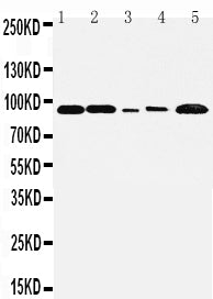 Anti-FGFR1 antibody, PA1477, Western blotting
Lane 1: Rat Liver Tissue Lysate
Lane 2: Rat Brain Tissue Lysate
Lane 3: SMMC Cell Lysate
Lane 4: HT1080 Cell Lysate
Lane 5: MM231 Cell Lysate