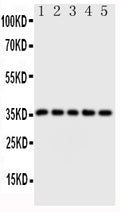 Anti-Fos B antibody, PA1478, Western blotting
Lane 1: HT1080 Cell Lysate 
Lane 2: SW620 Cell Lysate 
Lane 3: HELA Cell Lysate 
Lane 4: SMMC Cell Lysate 
Lane 5: MM453 Cell Lysate
