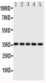 Anti-Fos B antibody, PA1478, Western blotting
Lane 1: HT1080 Cell Lysate 
Lane 2: SW620 Cell Lysate 
Lane 3: HELA Cell Lysate 
Lane 4: SMMC Cell Lysate 
Lane 5: MM453 Cell Lysate