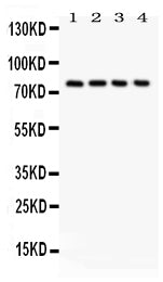 Anti-Tau antibody, PA1482, Western blotting
All lanes: Anti (PA1482) at 0.5ug/ml
Lane 1: Rat Brain Tissue Lysate at 50ug
Lane 2: Mouse Brain Tissue Lysate at 50ug
Lane 3: HT1080 Whole Cell Lysate at 40ug
Lane 4: MCF-7 Whole Cell Lysate at 40ug
Predicted bind size: 79KD
Observed bind size: 79KD