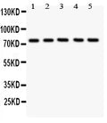 Anti-12 Lipoxygenase antibody, PA1485-1, Western blotting
All lanes: Anti ANOX12 (PA1485-1) at 0.5ug/ml

Lane 1: A549 Whole Cell Lysate at 40ug

Lane 2: MCF-7 Whole Cell Lysate at 40ug

Lane 3: COLO320 Whole Cell Lysate at 40ug

Lane 4: JURKAT Whole Cell Lysate at 40ug

Lane 5: HELA Whole Cell Lysate at 40ug

Predicted bind size: 75KD

Observed bind size: 75KD