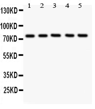 Anti-12 Lipoxygenase antibody, PA1485-1, Western blotting
All lanes: Anti ANOX12 (PA1485-1) at 0.5ug/ml

Lane 1: A549 Whole Cell Lysate at 40ug

Lane 2: MCF-7 Whole Cell Lysate at 40ug

Lane 3: COLO320 Whole Cell Lysate at 40ug

Lane 4: JURKAT Whole Cell Lysate at 40ug

Lane 5: HELA Whole Cell Lysate at 40ug

Predicted bind size: 75KD

Observed bind size: 75KD