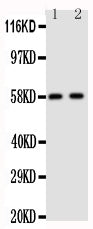 Anti-Aromatase antibody, PA1489, Western blotting
Lane 1: Human Placenta Tissue Lysate
Lane 2: Human Placenta Tissue Lysate