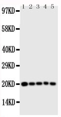 Anti-Caspase 4 antibody, PA1490, Western blotting
All lanes: Anti Caspase 4 (PA1490) at 0.5ug/ml

Lane 1: MCF-7 Whole Cell Lysate at 40ug

Lane 2: HELA Whole Cell Lysate at 40ug

Lane 3: JURKAT Whole Cell Lysate at 40ug

Lane 4: CEM Whole Cell Lysate at 40ug

Lane 5: SW620 Whole Cell Lysate at 40ug

Predicted bind size: 43KD

Observed bind size: 20KD