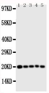 Anti-Caspase 4 antibody, PA1490, Western blotting
All lanes: Anti Caspase 4 (PA1490) at 0.5ug/ml

Lane 1: MCF-7 Whole Cell Lysate at 40ug

Lane 2: HELA Whole Cell Lysate at 40ug

Lane 3: JURKAT Whole Cell Lysate at 40ug

Lane 4: CEM Whole Cell Lysate at 40ug

Lane 5: SW620 Whole Cell Lysate at 40ug

Predicted bind size: 43KD

Observed bind size: 20KD