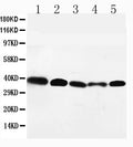 Anti-GPR2/CCR10 antibody, PA1491, Western blotting
Lane 1: HELA Cell Lysate
Lane 2: SW620 Cell Lysate
Lane 3: A549 Cell Lysate
Lane 4: MM231 Cell Lysate
Lane 5: SMMC Cell Lysate