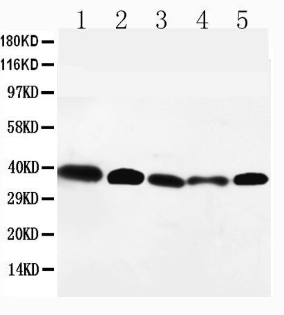 Anti-GPR2/CCR10 antibody, PA1491, Western blotting
Lane 1: HELA Cell Lysate
Lane 2: SW620 Cell Lysate
Lane 3: A549 Cell Lysate
Lane 4: MM231 Cell Lysate
Lane 5: SMMC Cell Lysate