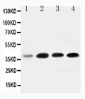 Anti-IGFBP3 Antibody Picoband®