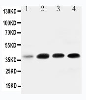 Anti-IGFBP3 Antibody Picoband®