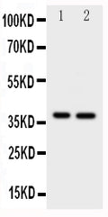 Anti-MCL1 antibody, PA1503, Western blotting
All lanes: Anti MCL1 (PA1503) at 0.5ug/ml

Lane 1: HELA Whole Cell Lysate at 40ug

Lane 2: MCF-7 Whole Cell Lysate at 40ug

Predicted bind size: 37KD

Observed bind size: 37KD