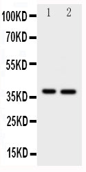 Anti-MCL1 antibody, PA1503, Western blotting
All lanes: Anti MCL1 (PA1503) at 0.5ug/ml

Lane 1: HELA Whole Cell Lysate at 40ug

Lane 2: MCF-7 Whole Cell Lysate at 40ug

Predicted bind size: 37KD

Observed bind size: 37KD