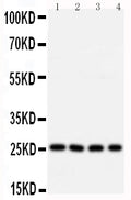 Anti-Bcl10 antibody, PA1504, Western blotting
Lane 1: U87 Cell Lysate
Lane 2: MCF-7 Cell Lysate
Lane 3: HELA Cell Lysate
Lane 4: COLO320 Cell Lysate