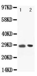 Anti-BOB1 antibody, PA1506, Western blotting
Lane: Rat Spleen Tissue Lysate